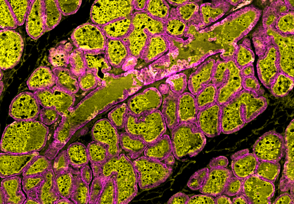 Milk-producing alveolar cells shown in magenta and milk protein shown in yellow in this cross-section of a mouse mammary gland at day five of lactation. (Image courtesy of Julien Menendez)