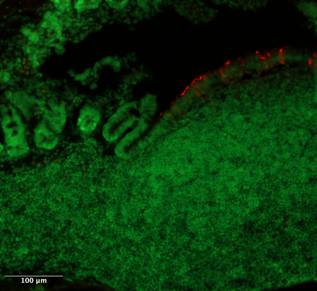 epithelium in the small intestine under the microscope